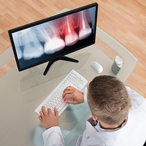 A dentist reviewing an X-ray on a computer.