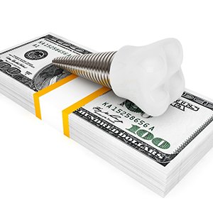 model dental implant on money stack representing cost of dental implants in Jupiter