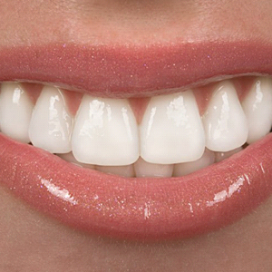 A closeup of a person’s smile.