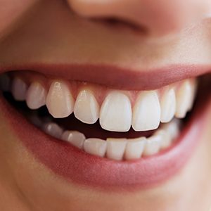 Closeup of healthy smile