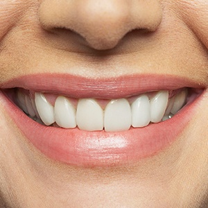 Closeup of flawless smile
