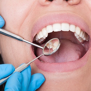 Closeup of smile during an exam