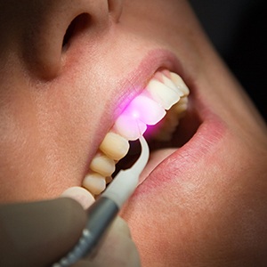 Patient receiving laser dentistry treatment