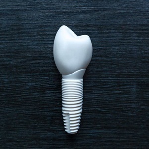 A dental implant resting on a table.