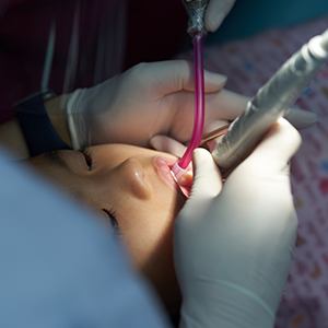 Relaxed patient during oral surgery