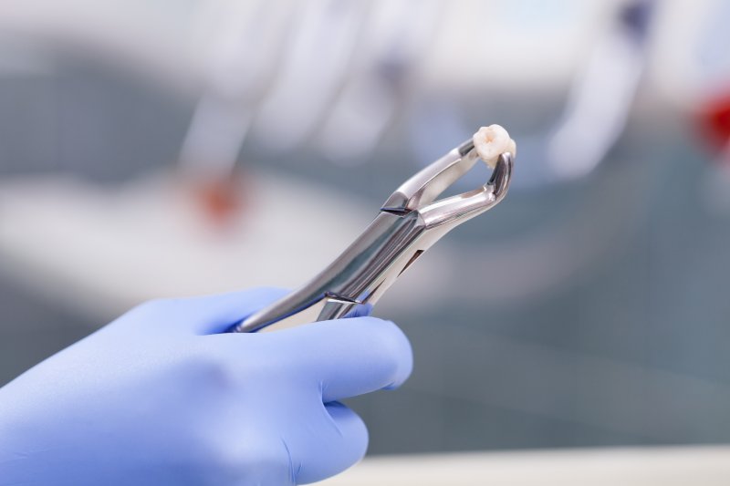 Hand holding forceps holding an extracted tooth