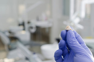 Gloved hand holding up an extracted tooth